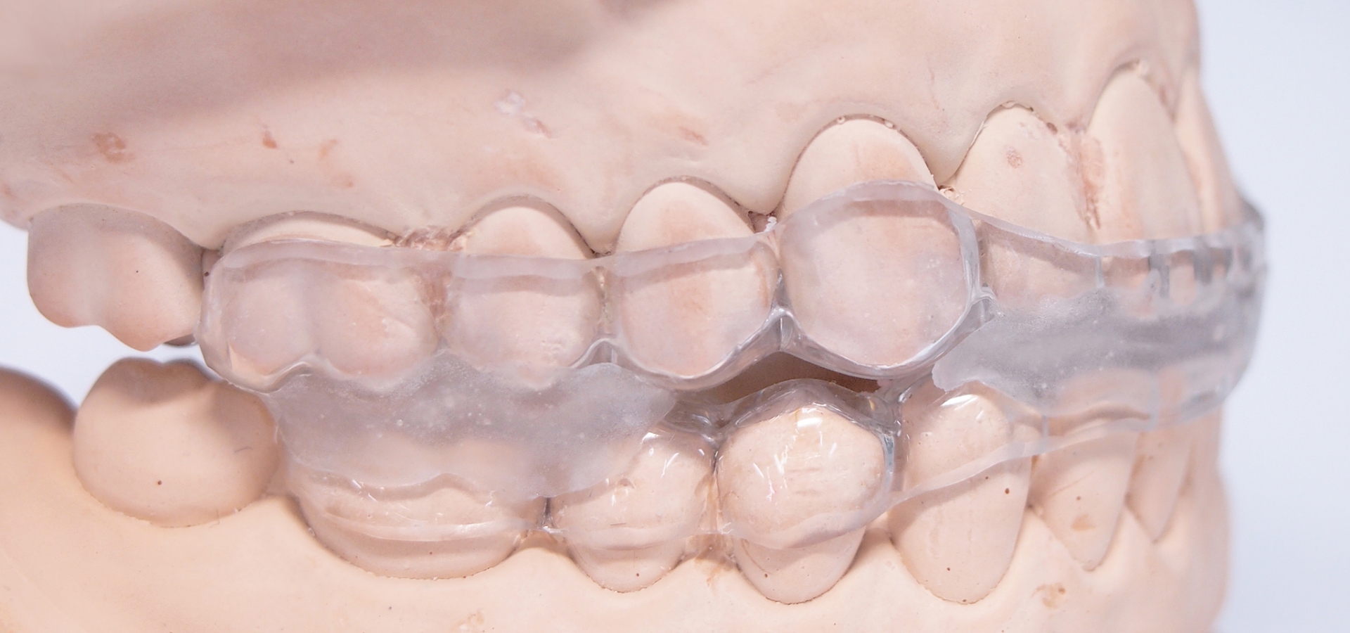 当院で行う歯周病対策